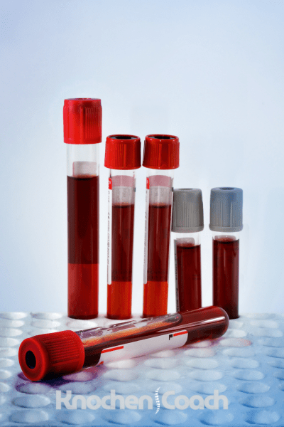 KnochenCoach Blutwerte